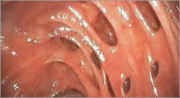 Es un procedimiento que le permite a un médico mirar directamente el interior del abdomen o la pelvis.